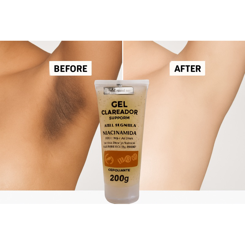 Gel Clareador Corporal Virilha Axila Niacinamida Esfoliante Matto Verde Antes e Depois Manchas Oleosidade