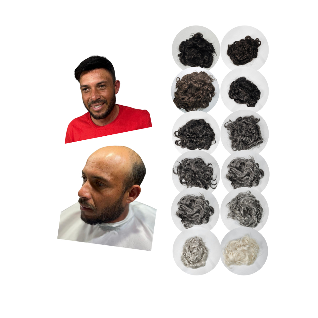 O que é Prótese Capilar Micropele 1b? Guia e Onde Comprar | BuscaProdutos