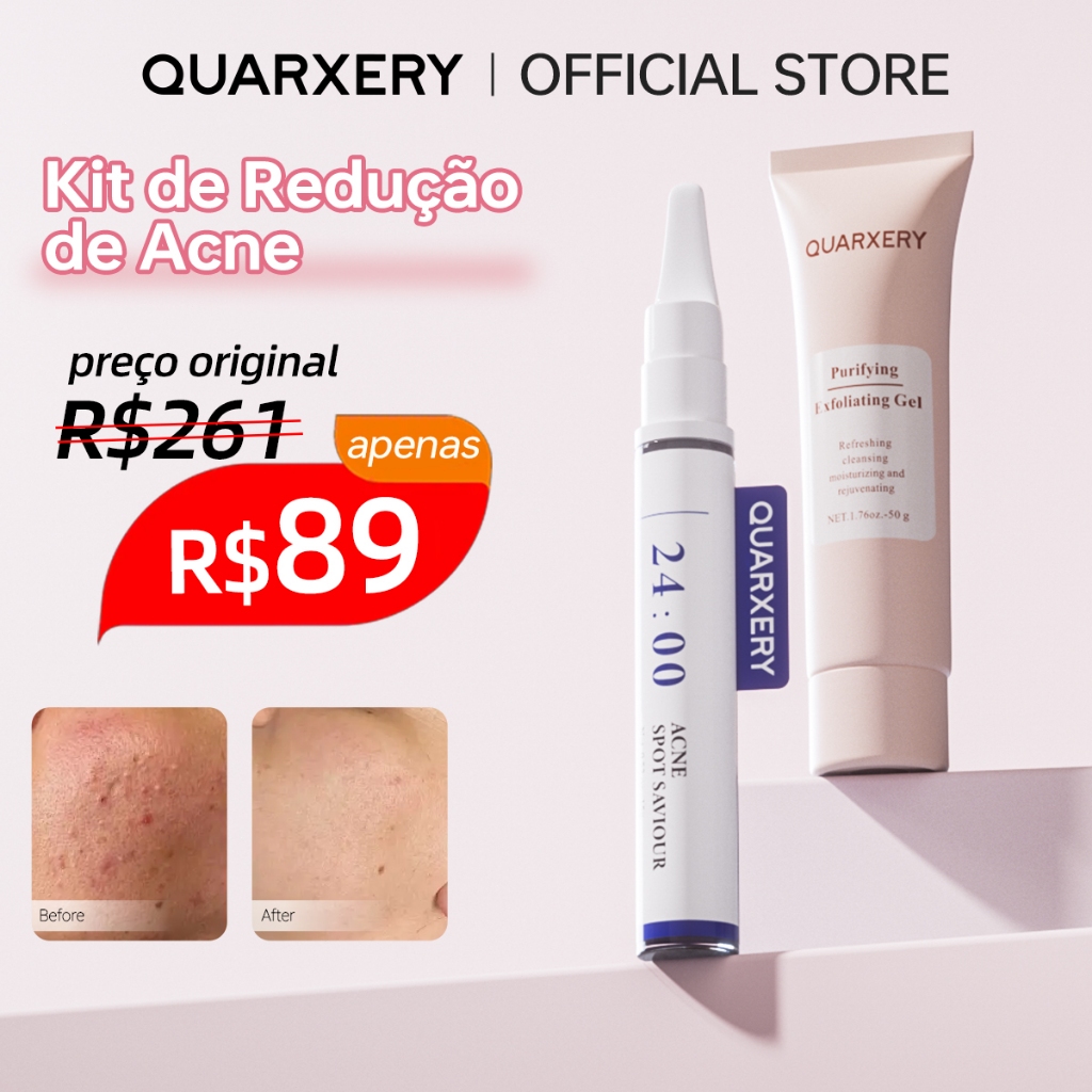 [Kit de Tratamento para Acne] Gel Exfoliante Clareador + Caneta de Gel para Acne - Remoção de Espinhas em Oferta na Shopee