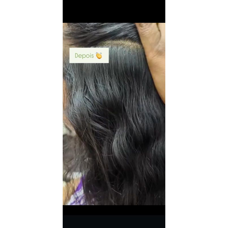 kit 1xopiolhos em Oferta na Shopee