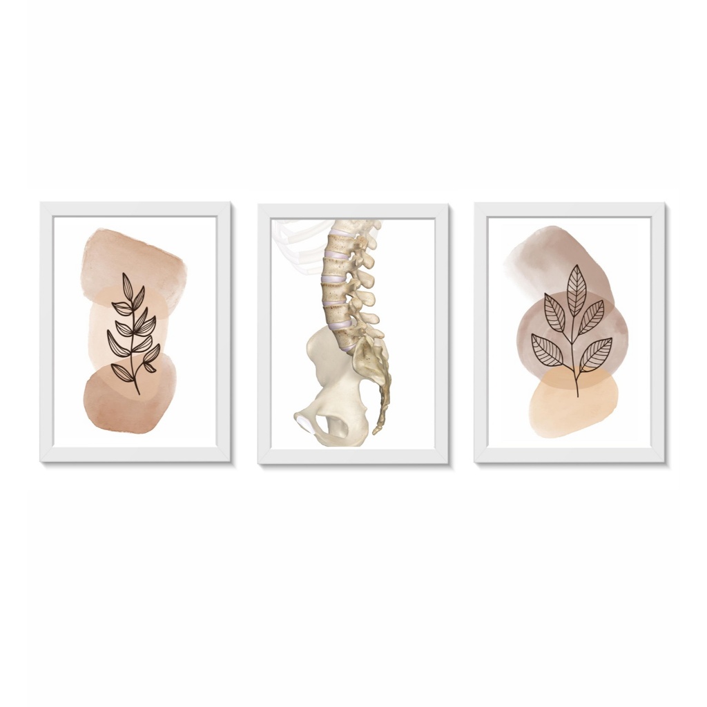 Kit 3 Quadros Decorativos Coluna Vertebral Ortopedia Fisioterapia Decoração Consultório Clínica Moldura 20x30cm Madeira