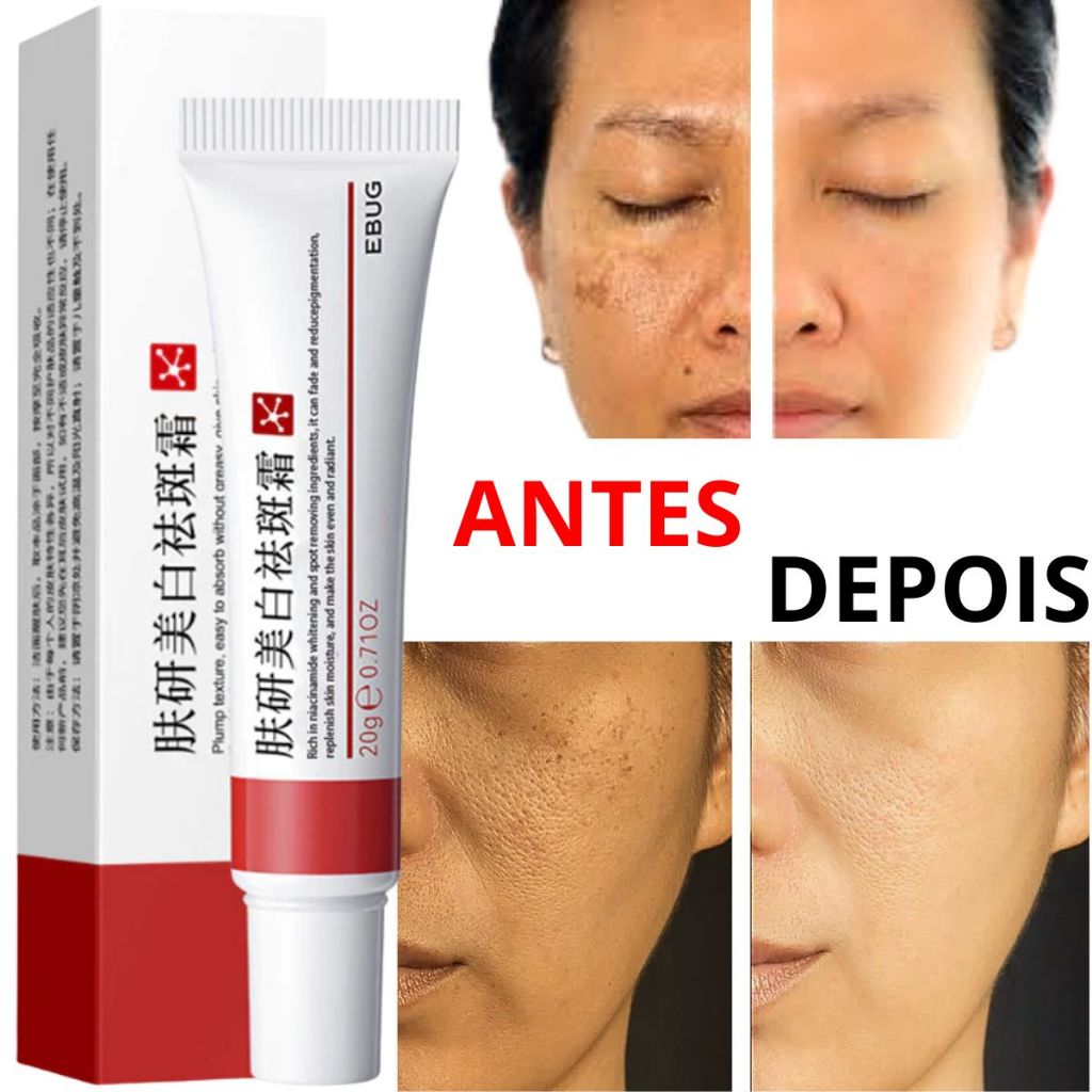 Creme Clareador Para Remover Melasma/Melanina/Removedor De Pele escura em Oferta na Shopee
