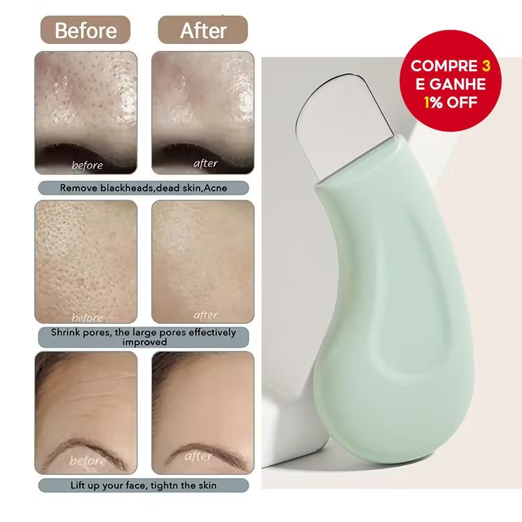 Espátula removedora de cravos, ferramenta de limpeza profunda do nariz para remoção de espinhas, dispositivo portátil em Oferta na Shopee
