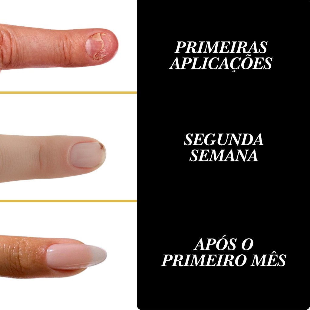 Base Fortalecedora Unhas 8ml Pacstar Anabolizante Crescimento Sem Formol Original