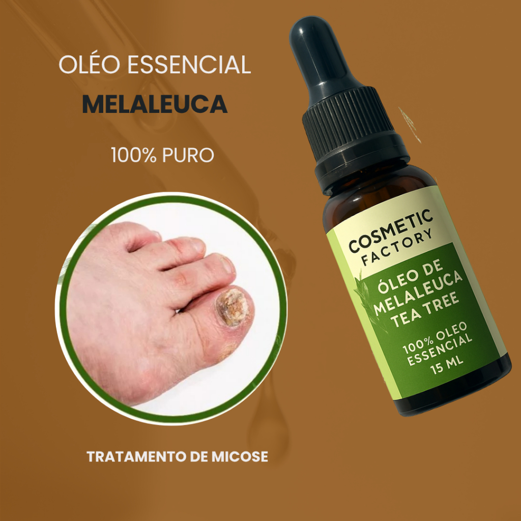 Óleo de Melaleuca 15ml Combate Micose Unhas; Oleosidade; Acne e Fortalece os Cabelos em Oferta na Shopee