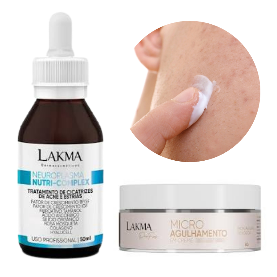 kit Microagulhamento sem Agulhas Lakma - Cicatrizes de Acne e Estrias - Nutri Complex + Creme Biológico