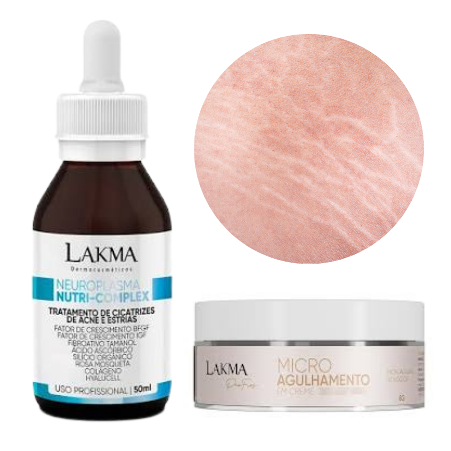 Microagulhamento para Estrias: Onde Comprar | BuscaProdutos