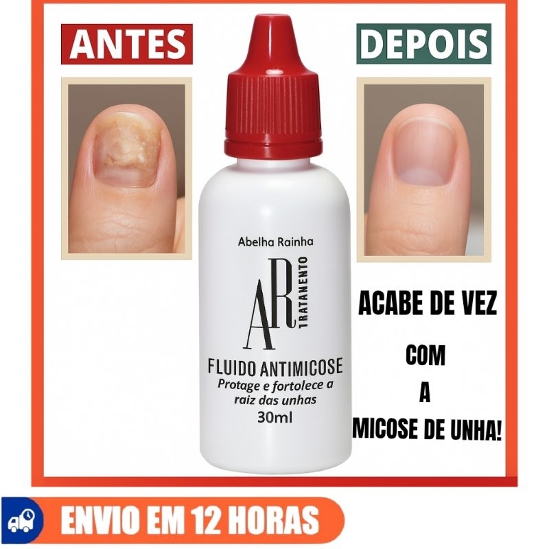 Fluido Anti Micose Remedio para unhas com fungos Melaleuca Abelha Rainha 30 ML micose de unha em Oferta na Shopee