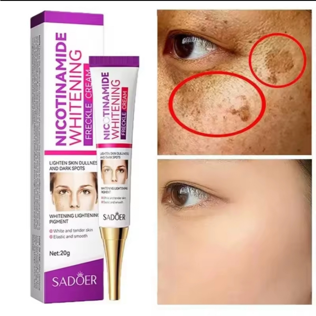 Creme Facial Sadoer Nicotinamida Clareador – Reduz Sardas e Melasma, Ilumina, Uniformiza o Tom e Rejuvenesce a Pele
