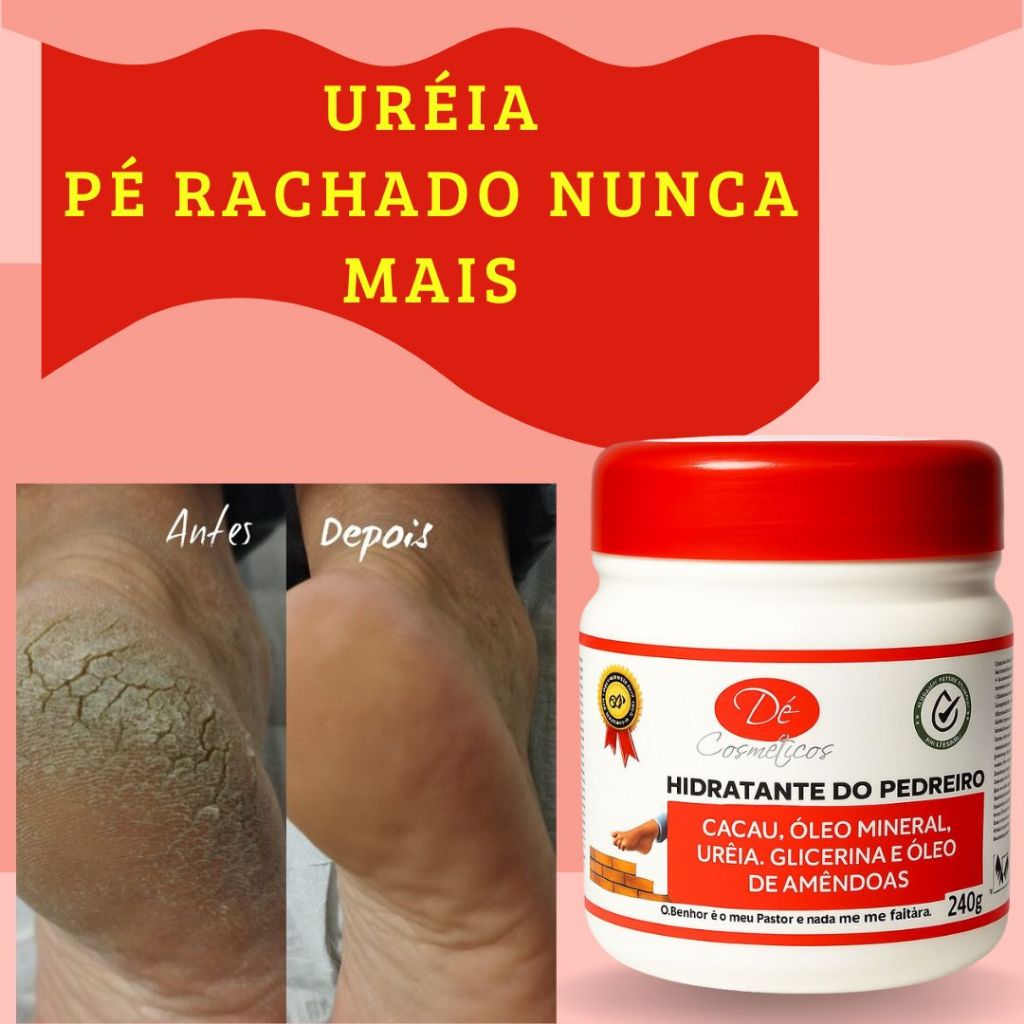 Creme de Pedreiro para os Pés Hidratante de Ureia 500g Rachados Mãos Ressecadas Cotovelos Pele Aspera 240g 120g 55g 30g em Oferta na Shopee