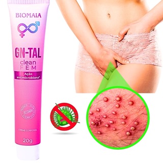 Pomada Íntima Feminina Antifúngica Combate a Coceira Vermelhidão Candidiase e Mau Cheiro em Oferta na Shopee