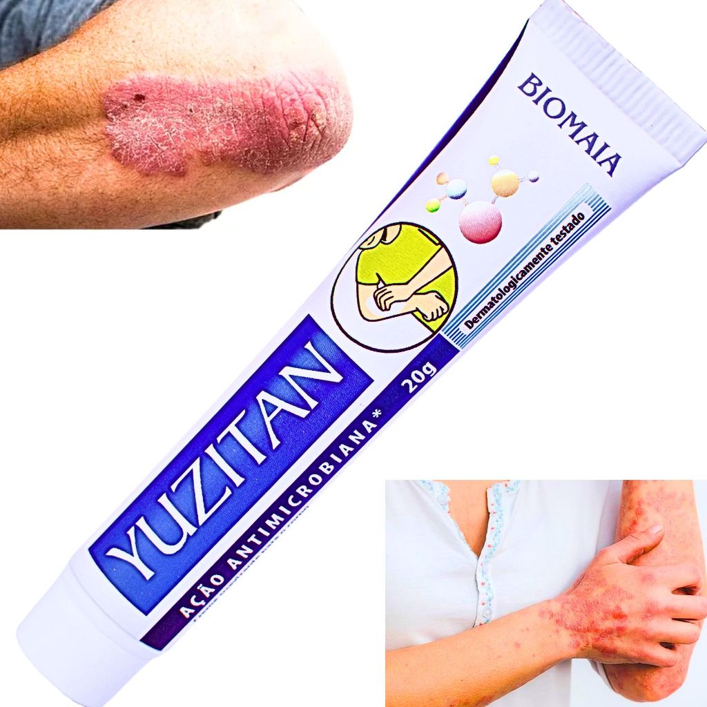 Pomada Alergia na Pele: Onde Comprar | BuscaProdutos