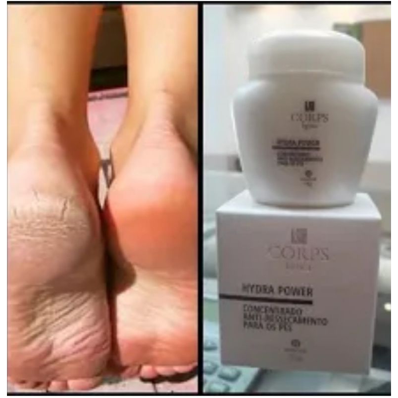Concentrado Anti Ressecamento Para Pés Hidra Power Corps Lígnea 55g