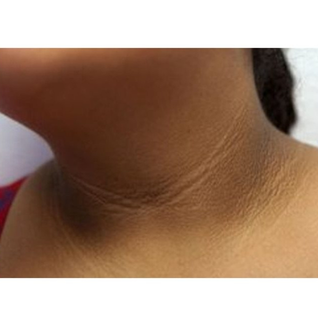 Creme Removedor de Manchas Tira Manchas Ação Antienvelhecimento 50g 1Un. NatyFlora — imagem 2 de 2