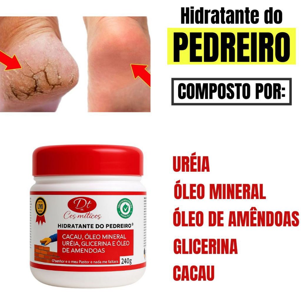 Creme Hidratante do Pedreiro  com Ureia Para Pés Rachados Glicerina Óleo de Amêndoas Cacau Corpo Mão 240g