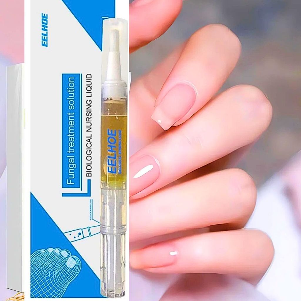 Caneta Anti-Micose e Anti-Fungo Nas Unhas/Tratamento Para Micose nas Unhas/onicomicose