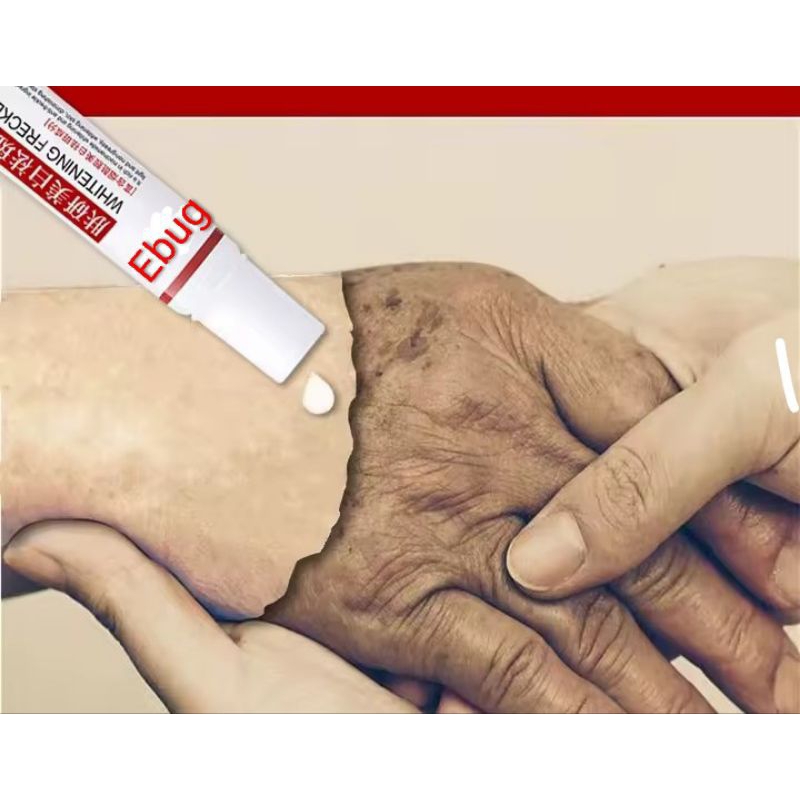 Creme Melasma Verdadeiro Original Pele Clarinha Brllhante