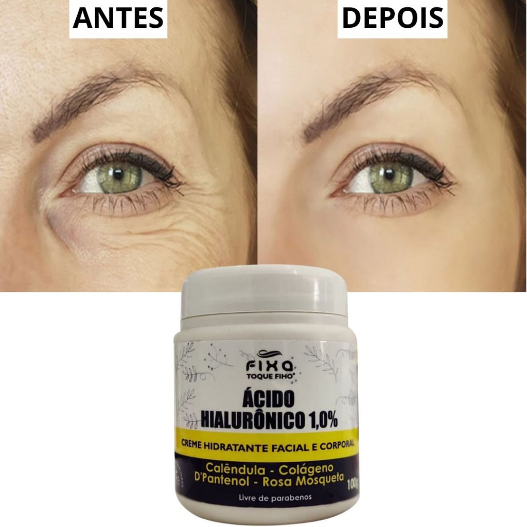 Creme Clareador Antissinais: Onde Comprar | BuscaProdutos