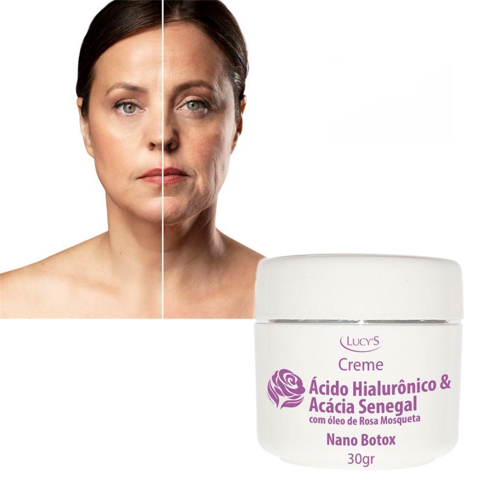 Creme Nano Botox Rugas Ác Hialurônico Com Rosa Mosqueta