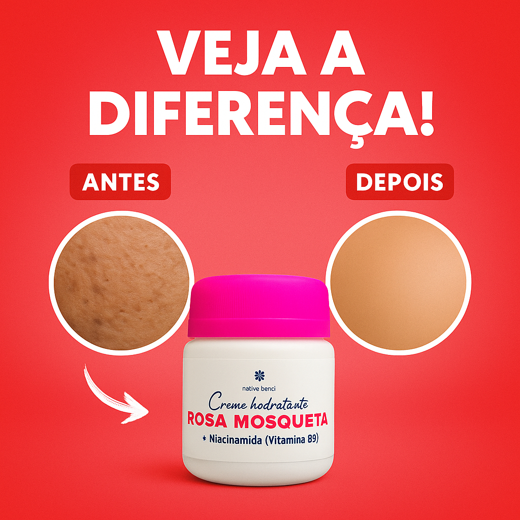 Creme Rosa Mosqueta Facial | Ação Clareadora para Melasma, Acne e Olheiras