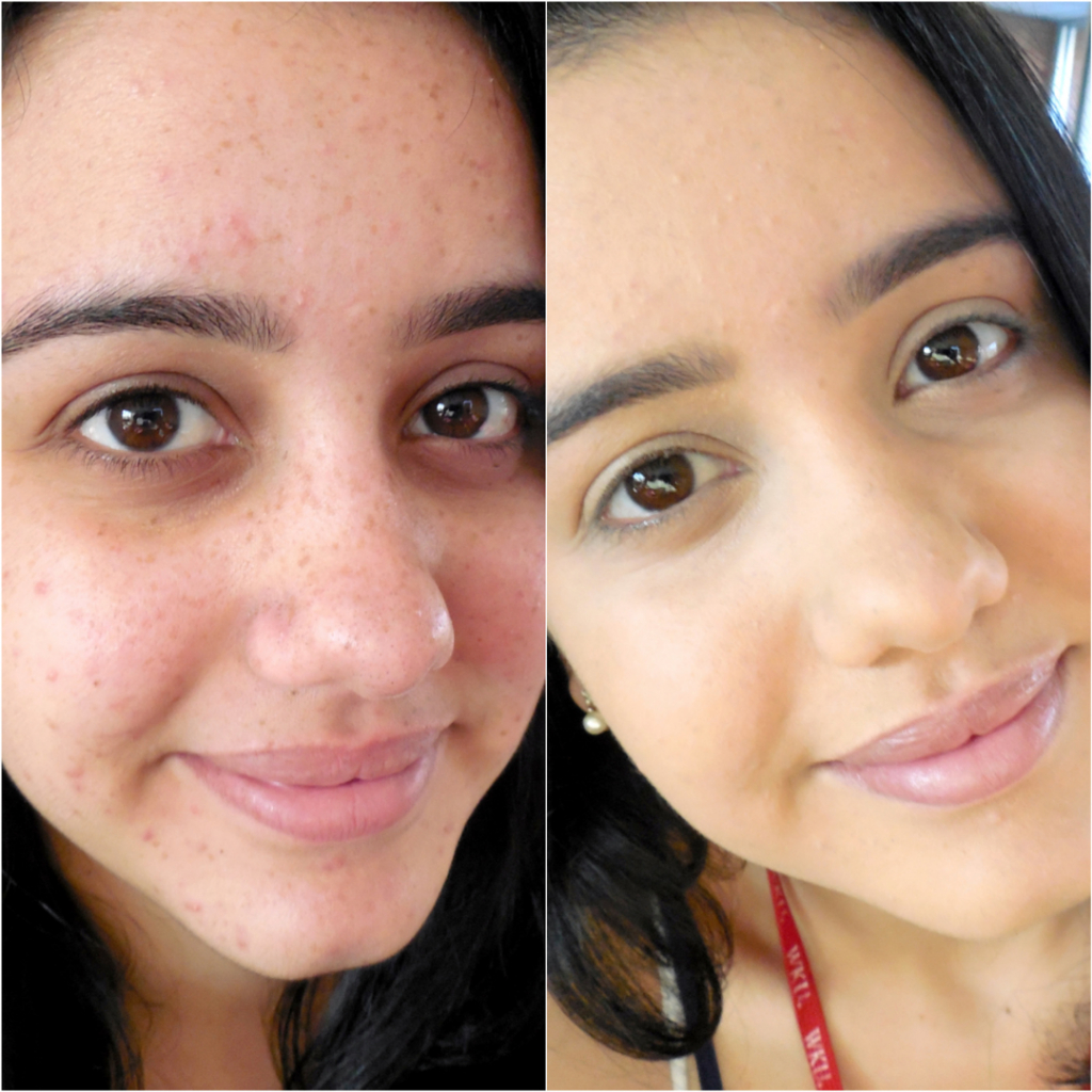 Base Liquida Média Cobertura e Hidratação Lovely Com Ácido Hialurônico Face Beautiful