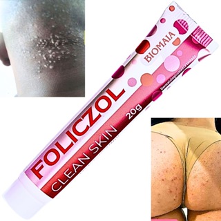 Foliculite como acabar com manchas e bolinhas na pele em Oferta na Shopee