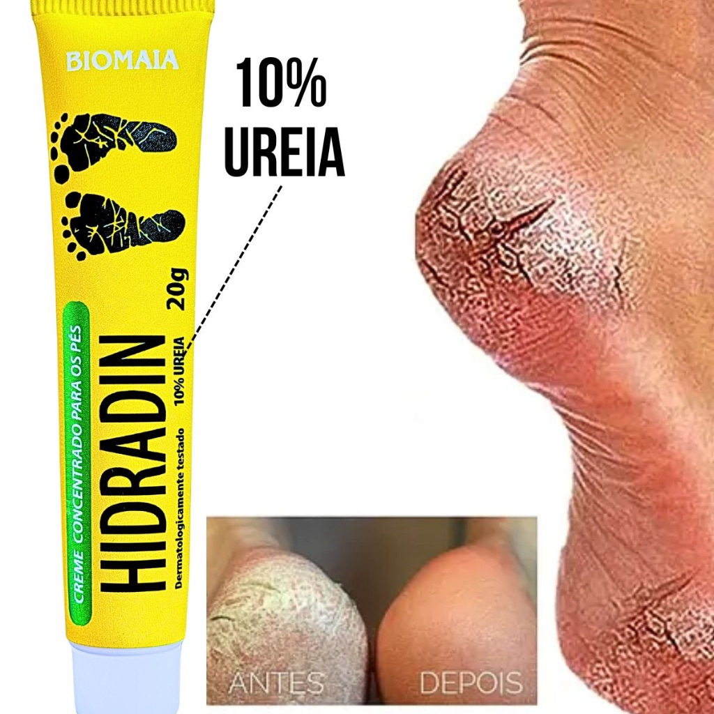 creme para rachadura nos pes em Oferta na Shopee