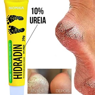 creme para rachadura nos pes em Oferta na Shopee