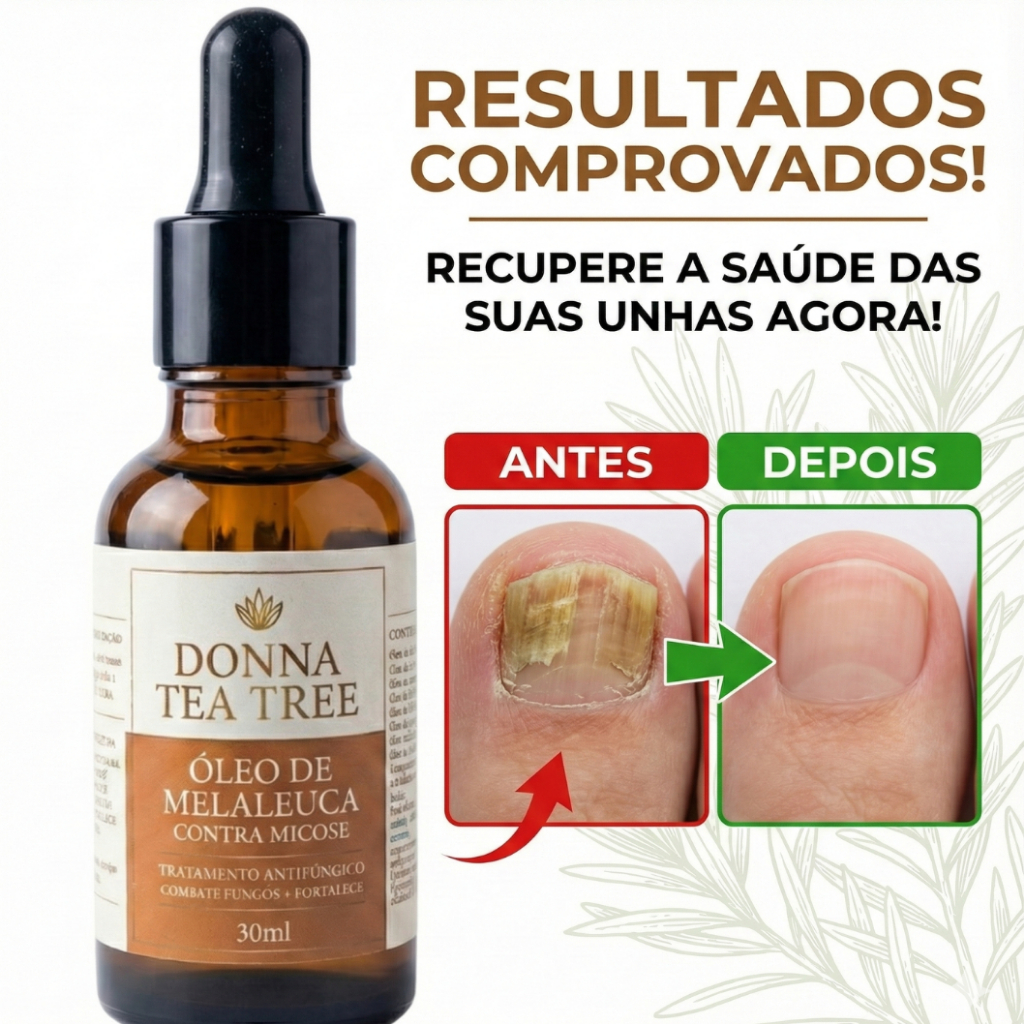 Imagem Óleo de Melaleuca Tea Tree Donna 30ml Antifúngico Natural para Unhas, Pele e Micose