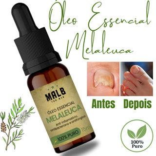 Oleo Essencial Melaleuca 100% Puro Australiano Tea Tree 15ML- Malb For Men em Oferta na Shopee