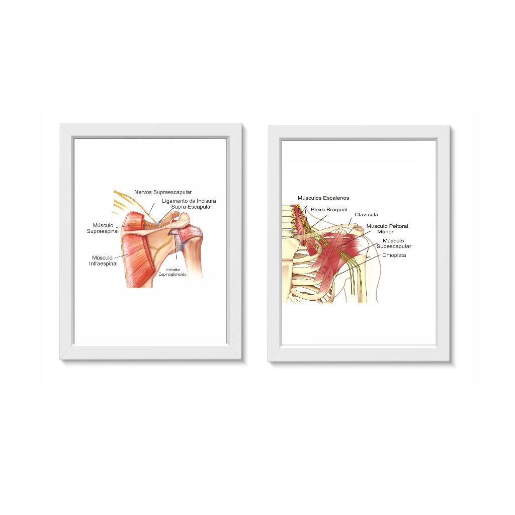Kit 2 Quadros Decoartivos Anatomia do Ombro Consultório Médico Ortopedia Fisioterapia Molduras 30x40cm Madeira