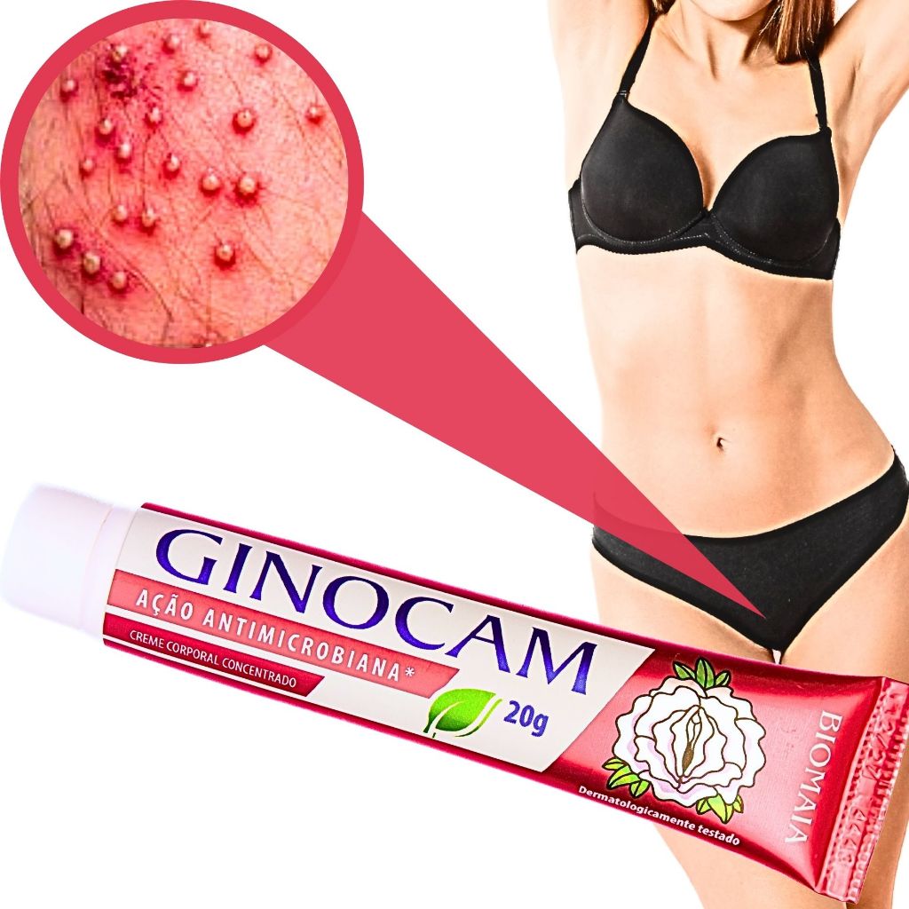 Pomada Doenças Femininas Partes Intimas Vaginose Herpes Neutra