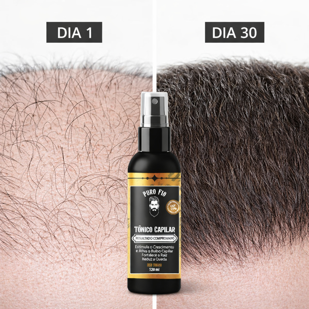 Tônico Capilar 15% Anti Queda Serum de Crescimento Poderoso Barba Cabelo Sobrancelha Bigode Kit g