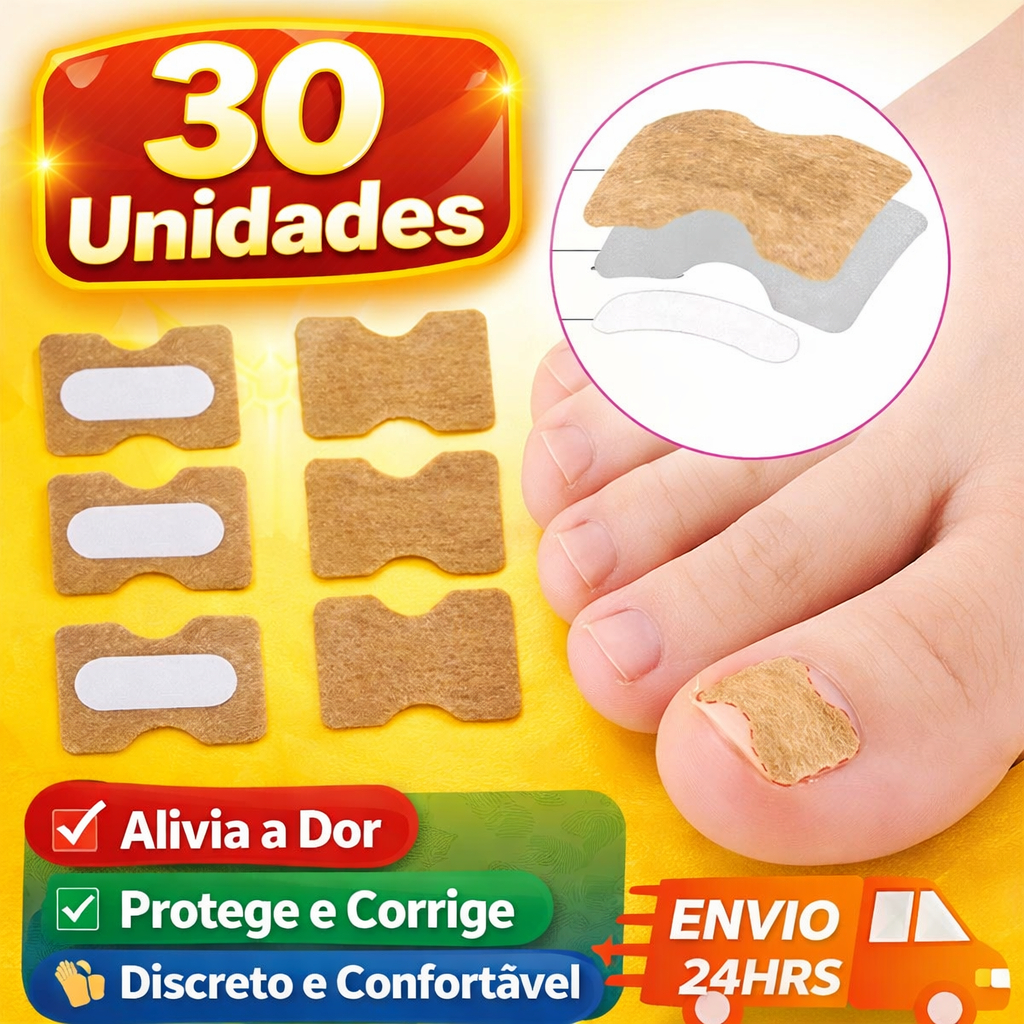 Kit 30/60 Adesivos Órtese para Unha Encravada - Correção Instantânea para Pedicure e Manicure