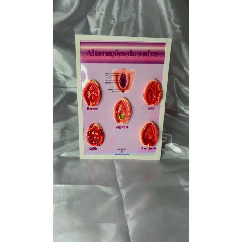 Macromodelo didático - Simulador de saúde da mulher