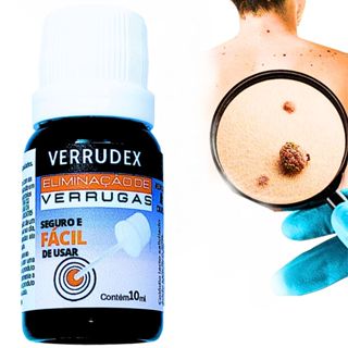 Cuidado tópico para pele com verruga e sensibilidade local em Oferta na Shopee