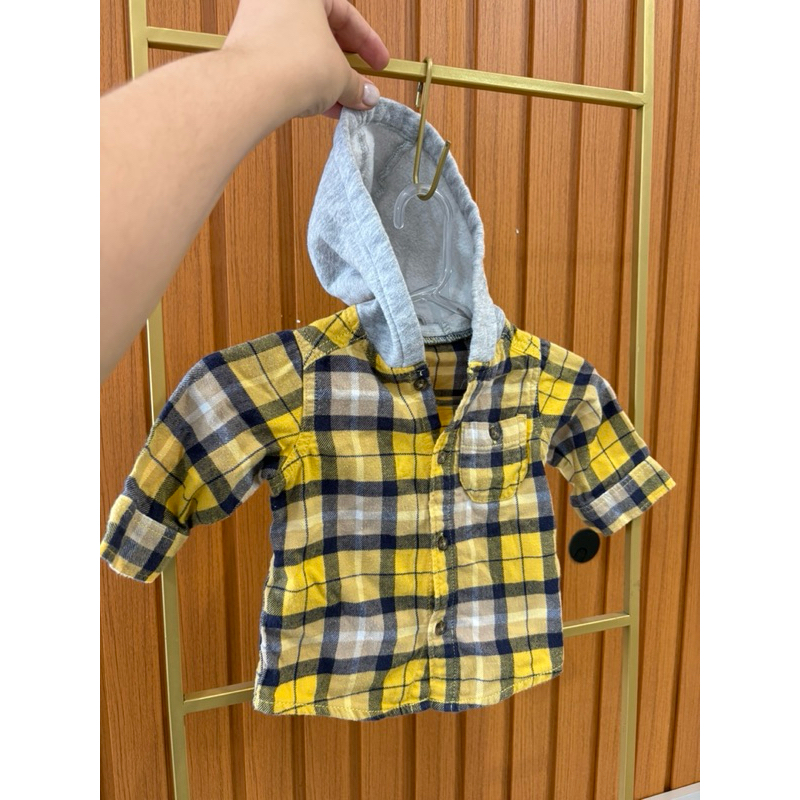 Casaquinho Bebê Algodão Amarelo Xadrez - Enxoval Importado (Básico Essencial)
