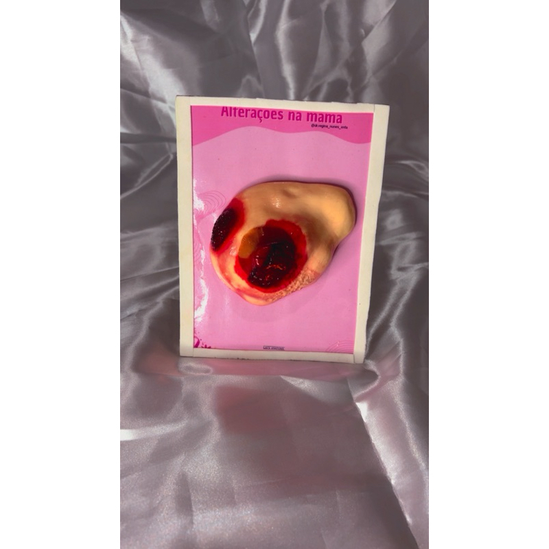 Macromodelo didático - saúde da mulher