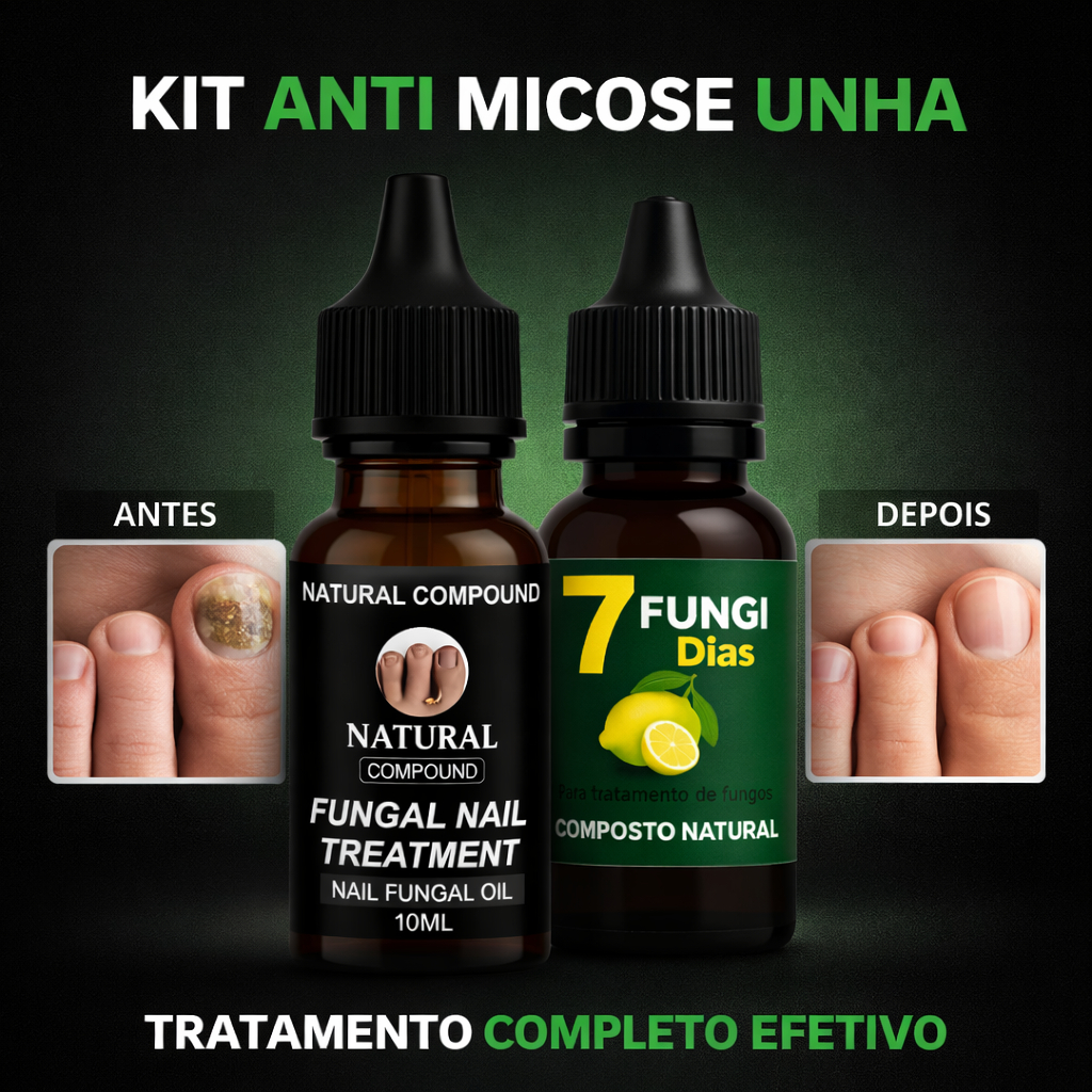 Kit Anti Micose Unha | Tratamento Fungos Unhas | Natural | Alta Procura 10ml preta e verde