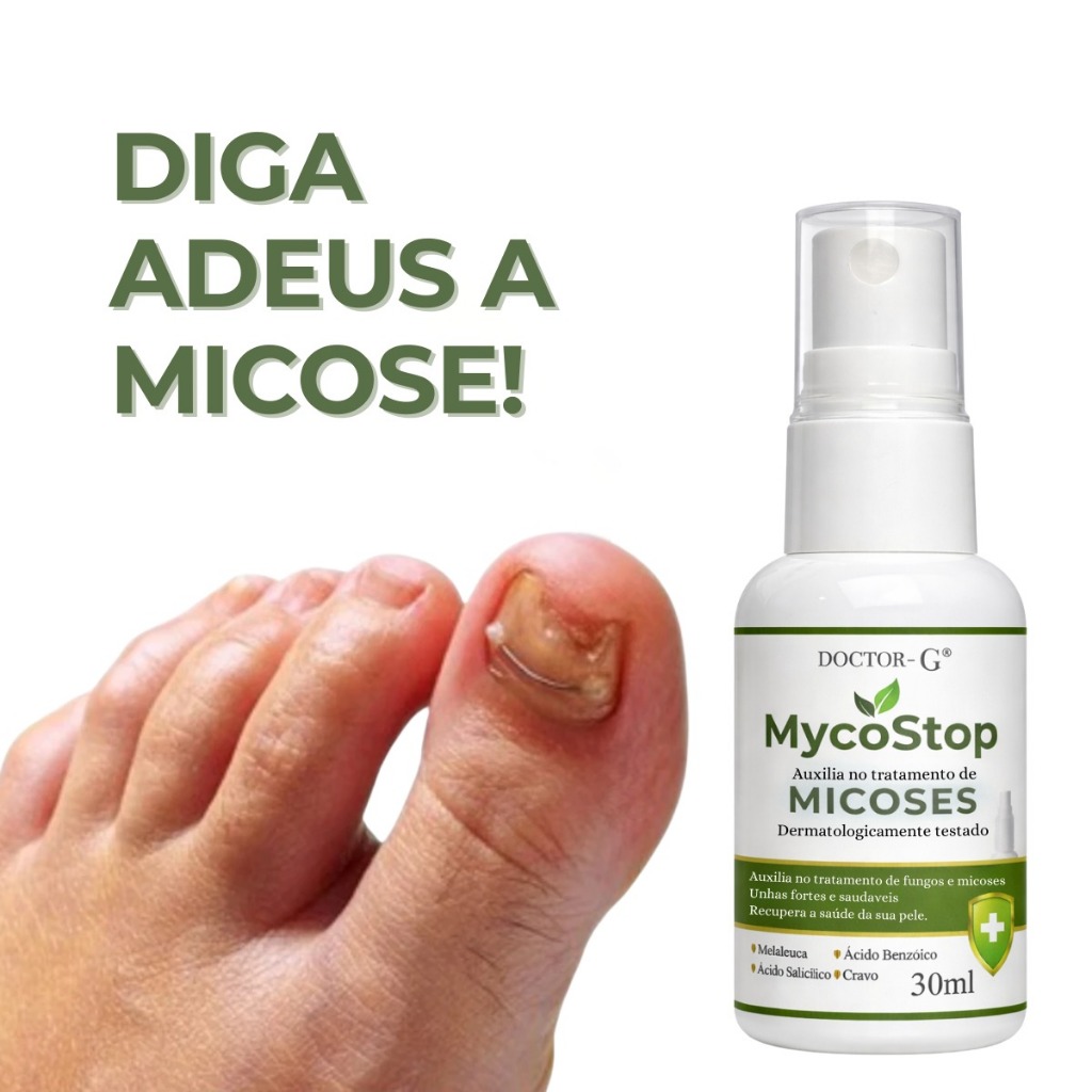 Mycostop Spray  para Micose de Unha, Antimicótico 30ml spray Doctor-G
