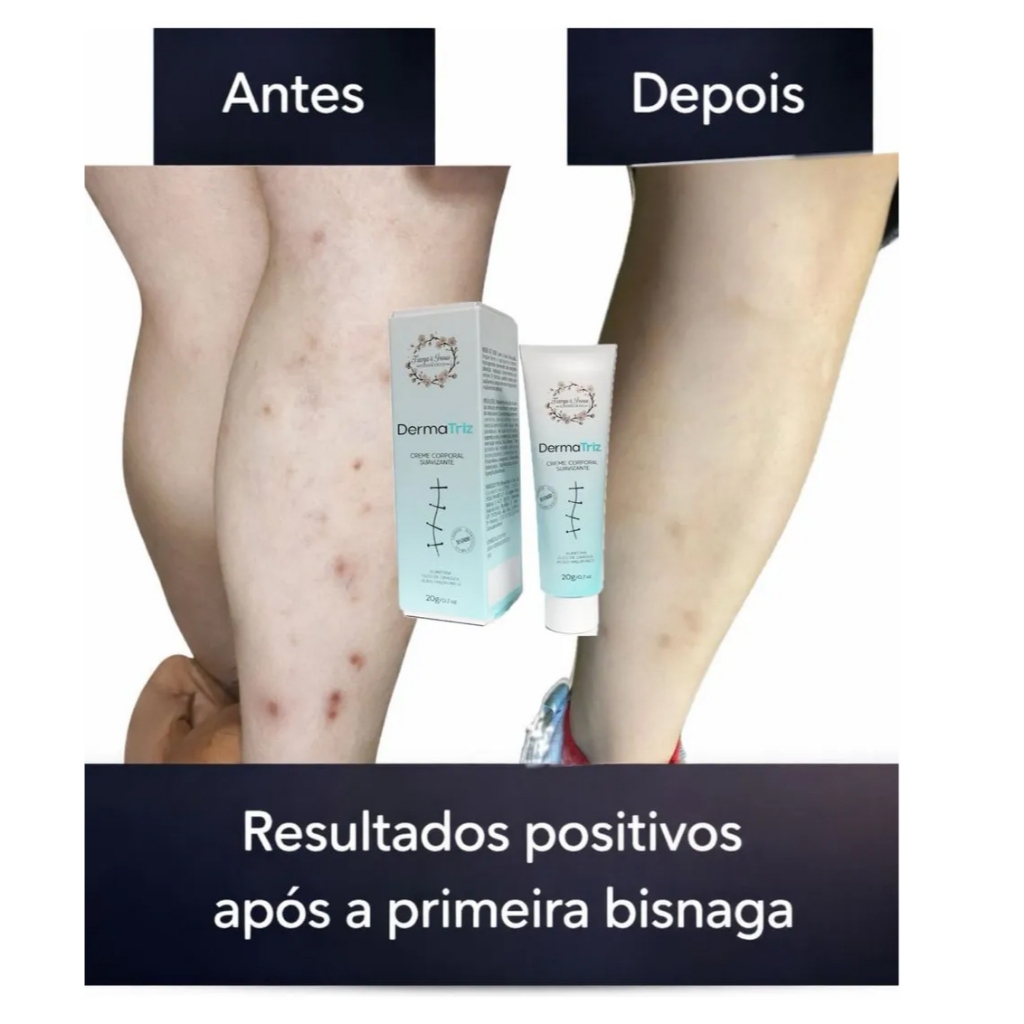 Creme Para Tratamento De Cicatriz Tg 20g