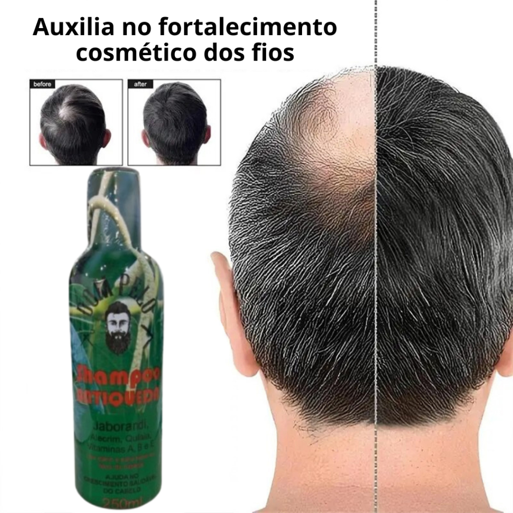 Shampoo para Cabelos Dom Pelo com Jaborandi, Alecrim e Quilaia – Fios Mais Fortes e Saudáveis