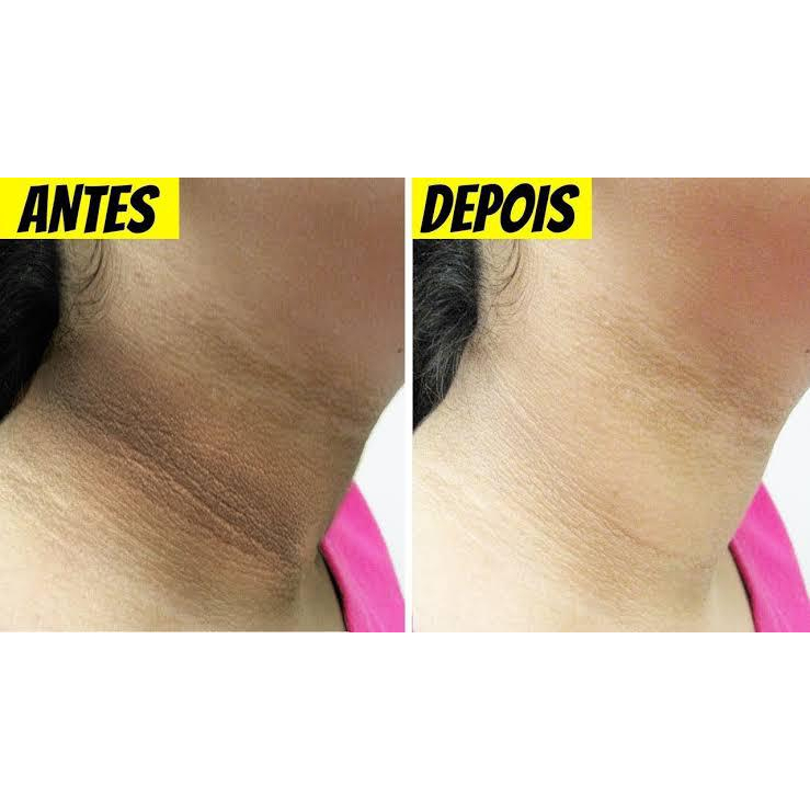 Clareador de Pele NatyFlora - Clareia Manchas, Hidratação e Antienvelhecimento