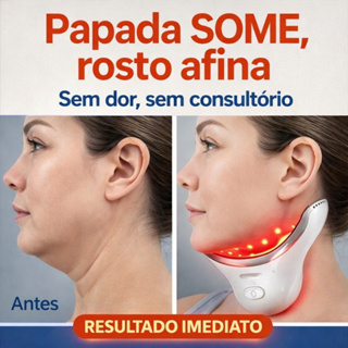 Massageador Facial LED Reduz Papada e Flacidez | Lifting Facial Com Calor em Oferta na Shopee