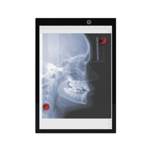 Negatoscópio com imã Grande A3 ou A4 Chapa Radiografia Portátil em Oferta na Shopee