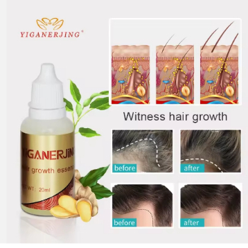 Ginseng Hair Growth Essence Oil, Anti-Hair Loss, Produto para Cabelo ,20ml