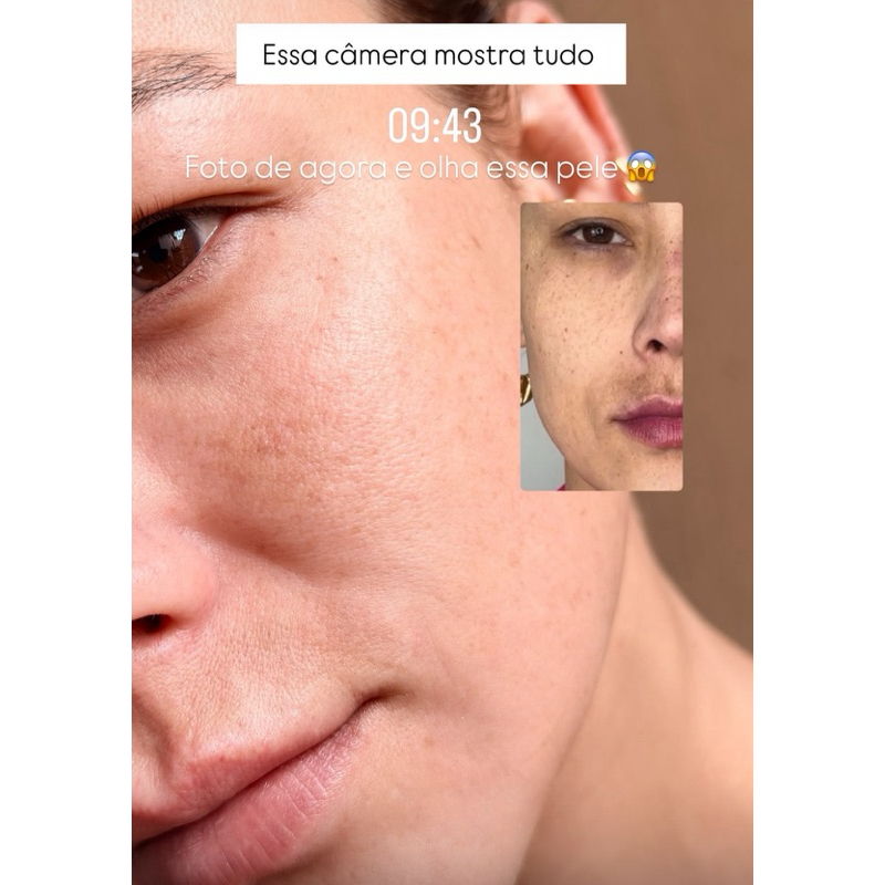Sérum Facial Clareador De Manchas Melasma Clear Dermachem Original