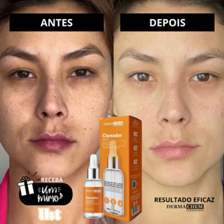 Sérum Facial Clareador De Manchas Melasma Clear Dermachem Original em Oferta na Shopee