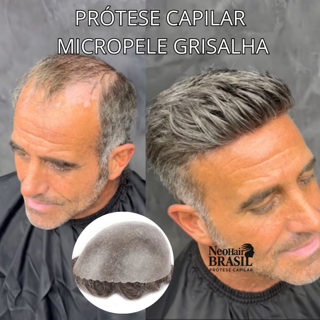 PRÓTESE CAPILAR MICROPELE FIO BRANCO/GRISALHA/ GRISALHO MASCULINA