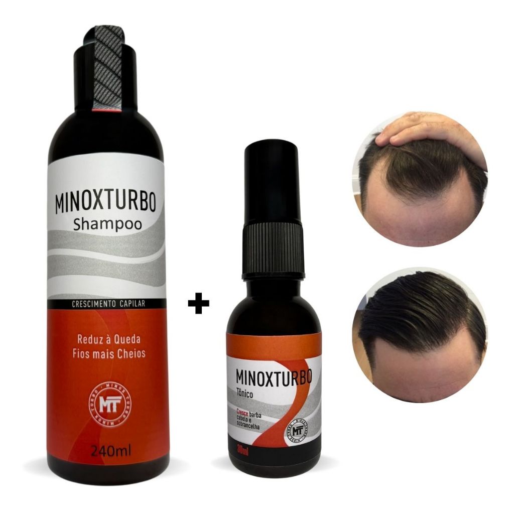 Combo Tratamento Capilar Shampoo e Tonico Anti Queda Cresce Nasce Cabelo